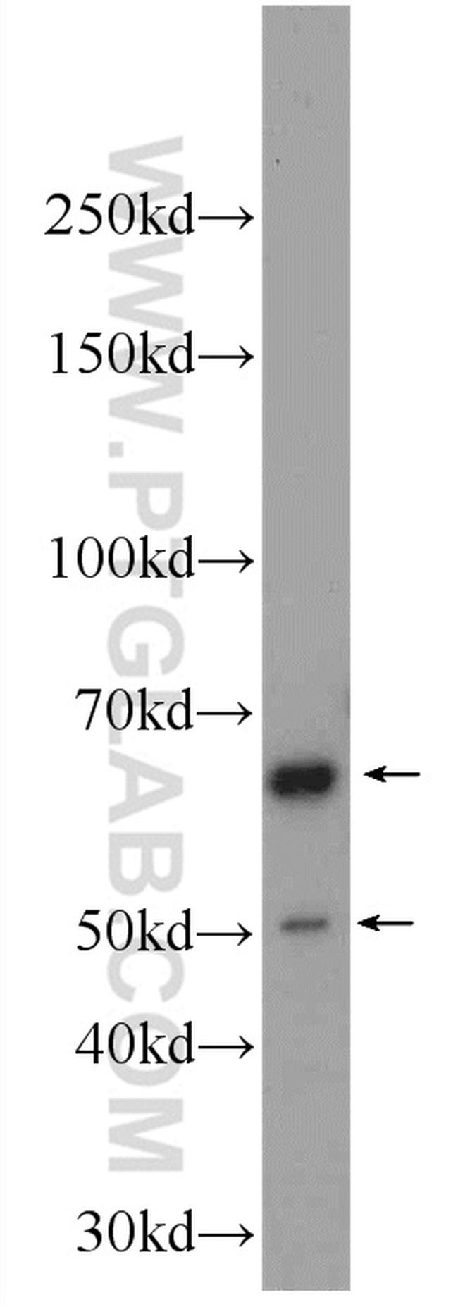 CHAT Antibody in Western Blot (WB)