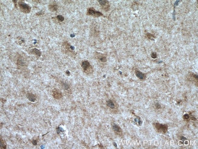 TALPID3 Antibody in Immunohistochemistry (Paraffin) (IHC (P))