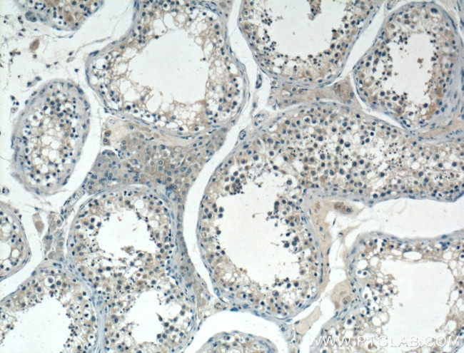 SPAG9 Antibody in Immunohistochemistry (Paraffin) (IHC (P))