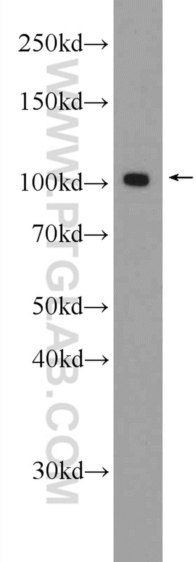 SPAG9 Antibody in Western Blot (WB)