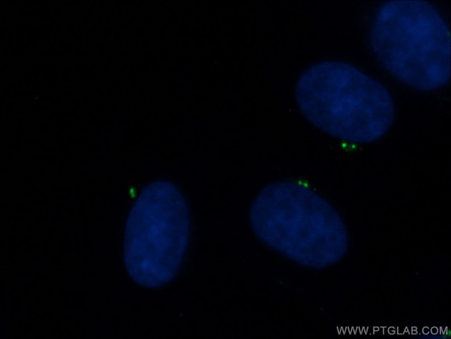 CEP135 Antibody in Immunocytochemistry (ICC/IF)