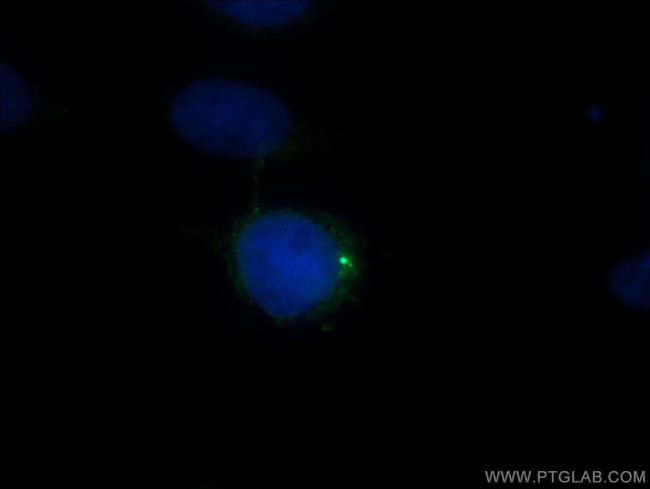 CEP135 Antibody in Immunocytochemistry (ICC/IF)