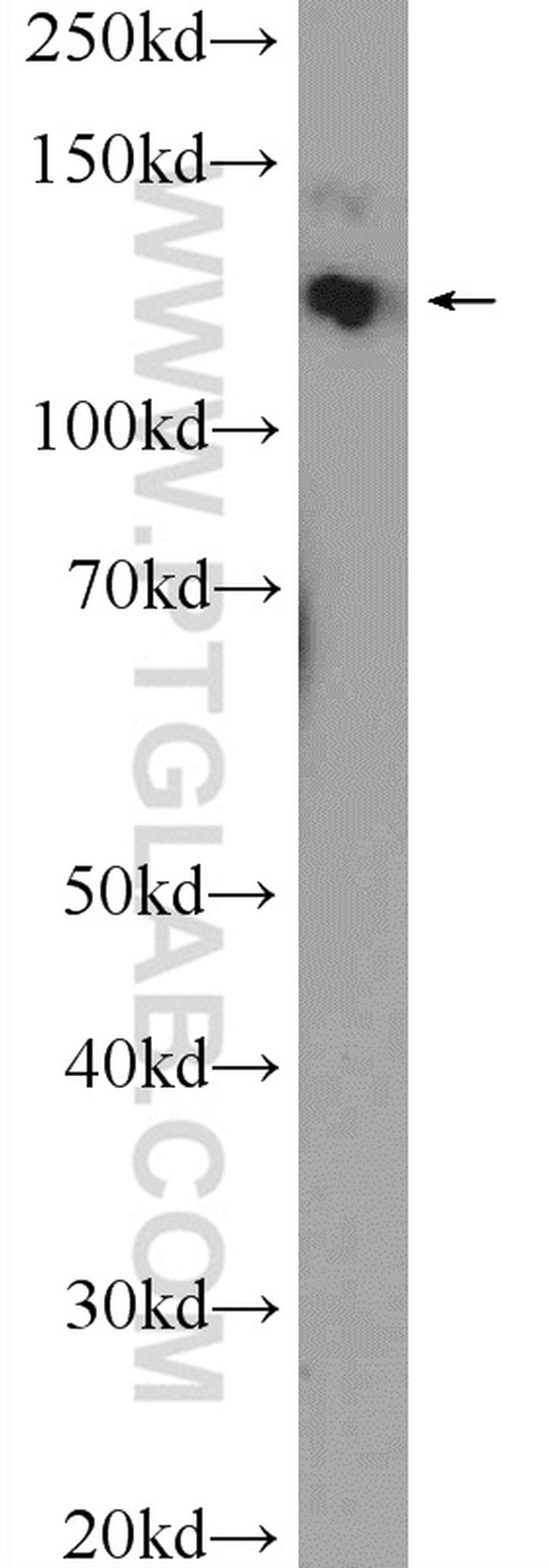 CEP135 Antibody in Western Blot (WB)