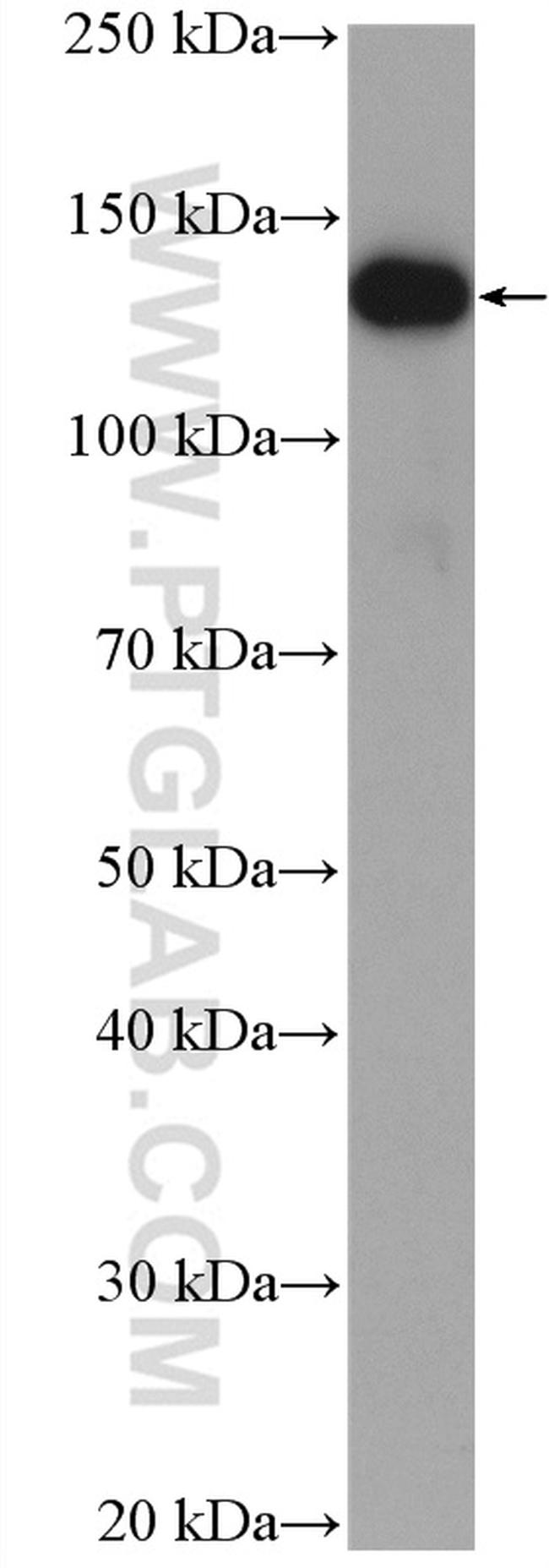 CEP135 Antibody in Western Blot (WB)