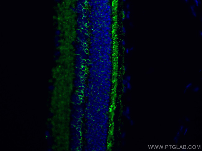 RS1 Antibody in Immunohistochemistry (PFA fixed) (IHC (PFA))