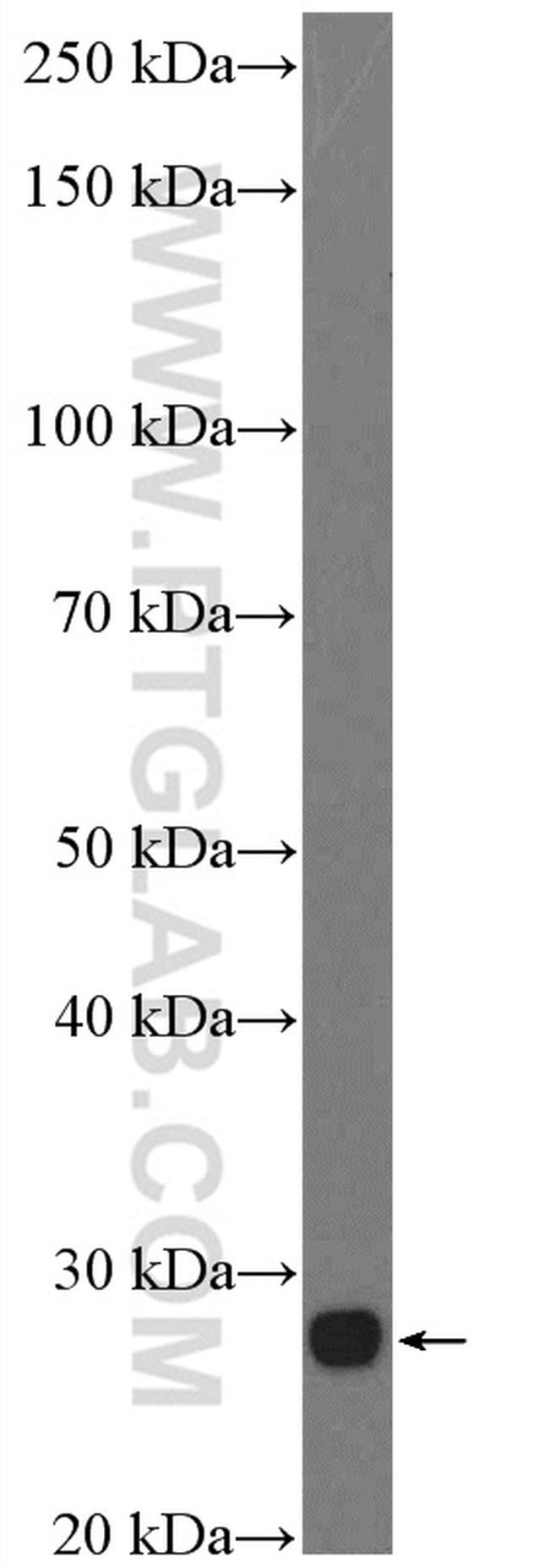 RS1 Antibody in Western Blot (WB)