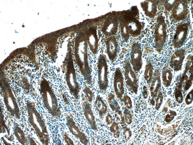 NUP205 Antibody in Immunohistochemistry (Paraffin) (IHC (P))