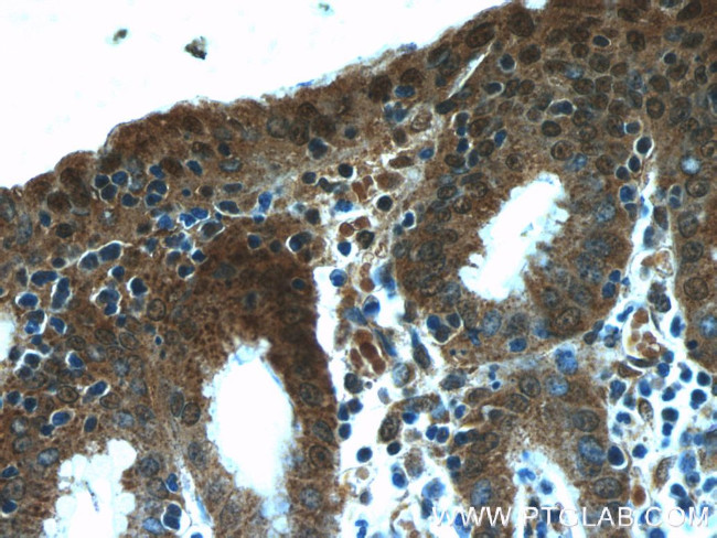 NUP205 Antibody in Immunohistochemistry (Paraffin) (IHC (P))