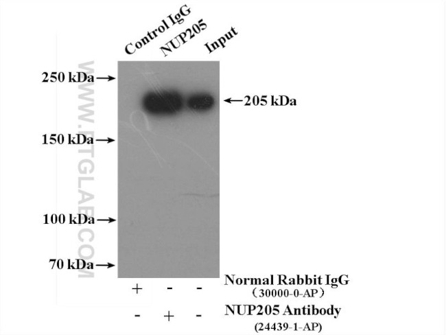 NUP205 Antibody in Immunoprecipitation (IP)