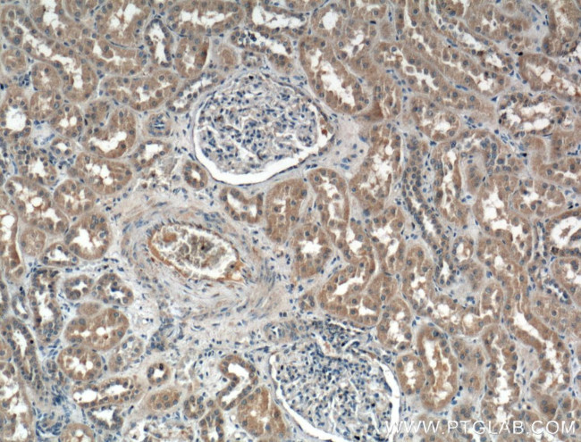 CCBE1 Antibody in Immunohistochemistry (Paraffin) (IHC (P))