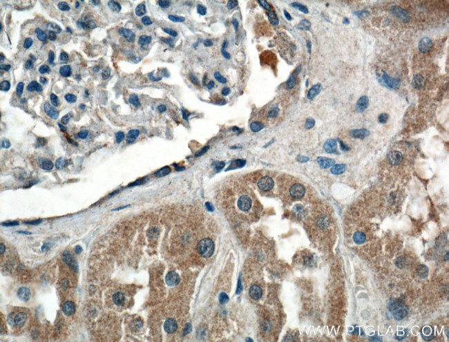 CCBE1 Antibody in Immunohistochemistry (Paraffin) (IHC (P))