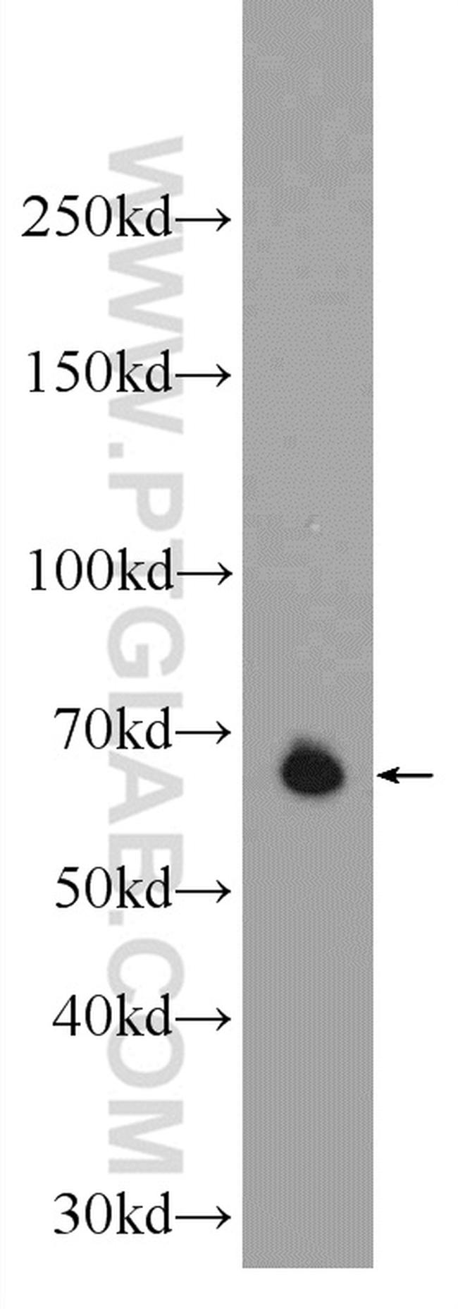 EXOSC9 Antibody in Western Blot (WB)