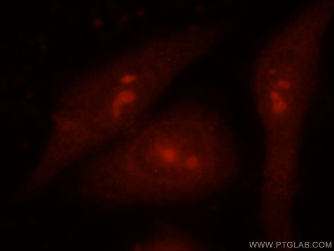 EXOSC9 Antibody in Immunocytochemistry (ICC/IF)