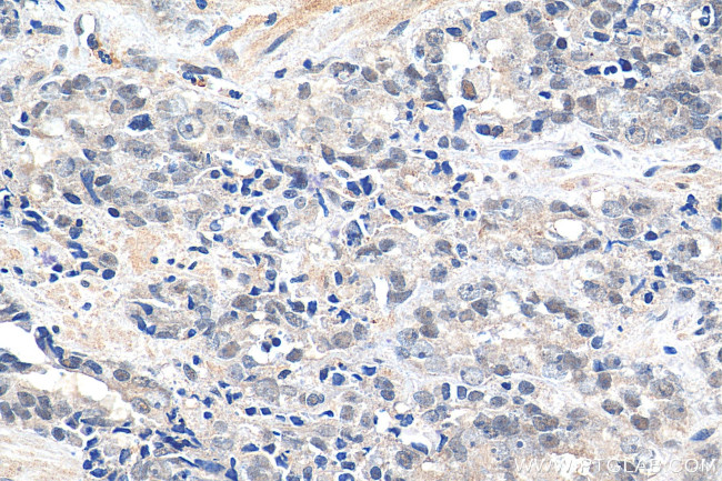 EXOSC9 Antibody in Immunohistochemistry (Paraffin) (IHC (P))