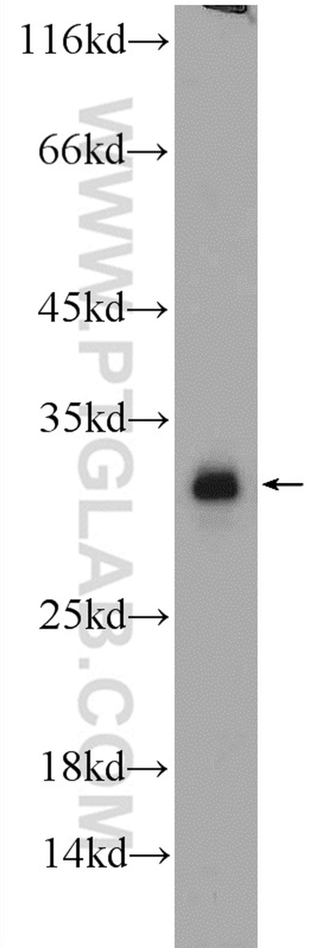 C20orf11 Antibody in Western Blot (WB)