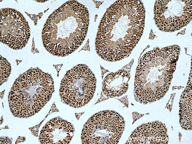 C20orf11 Antibody in Immunohistochemistry (Paraffin) (IHC (P))