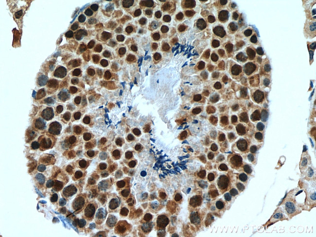 C20orf11 Antibody in Immunohistochemistry (Paraffin) (IHC (P))