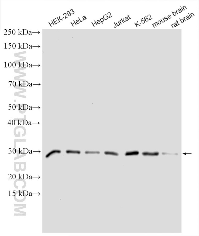 C20orf11 Antibody in Western Blot (WB)