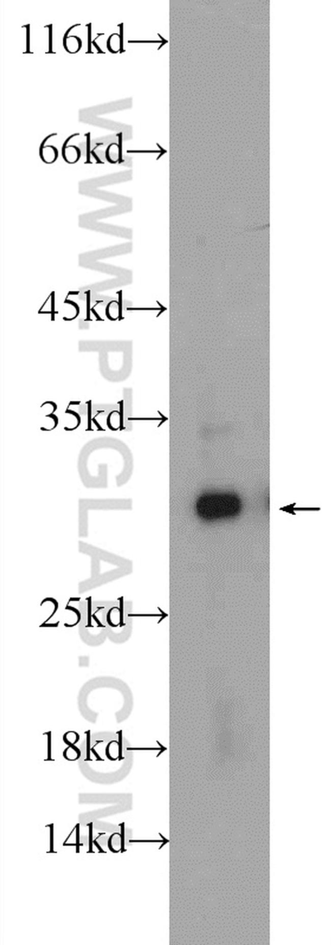 C20orf11 Antibody in Western Blot (WB)