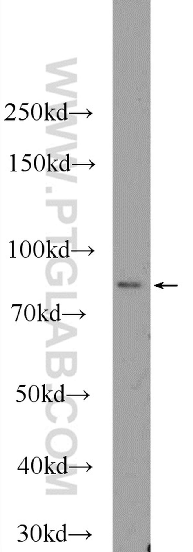 PRPF39 Antibody in Western Blot (WB)