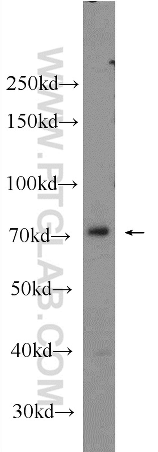 PRPF39 Antibody in Western Blot (WB)