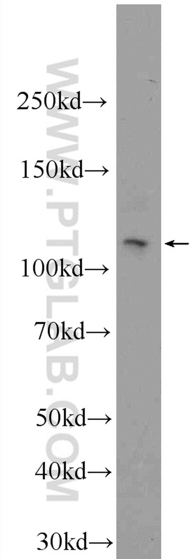 PHF12 Antibody in Western Blot (WB)