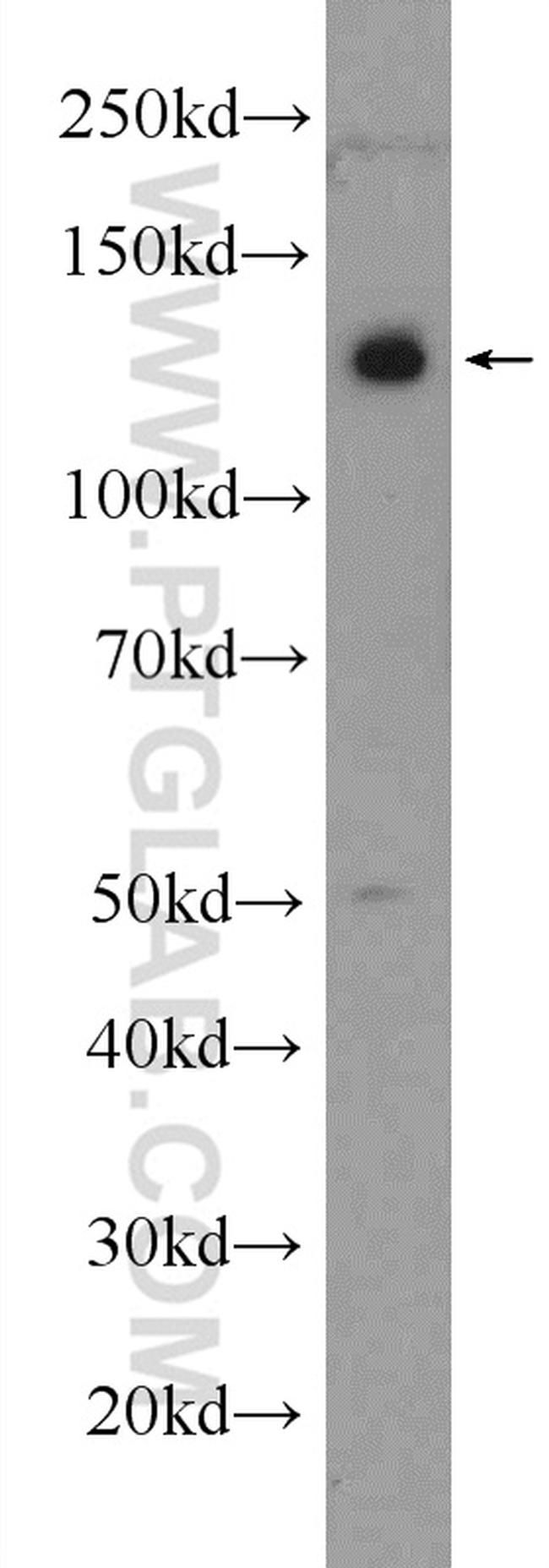 PHF12 Antibody in Western Blot (WB)