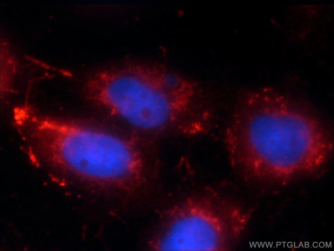 RRP7A Antibody in Immunocytochemistry (ICC/IF)