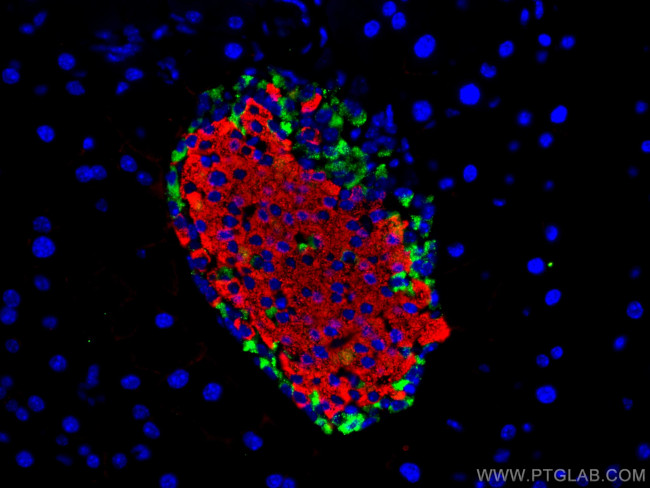 Somatostatin (1-116aa) Antibody in Immunohistochemistry (Paraffin) (IHC (P))