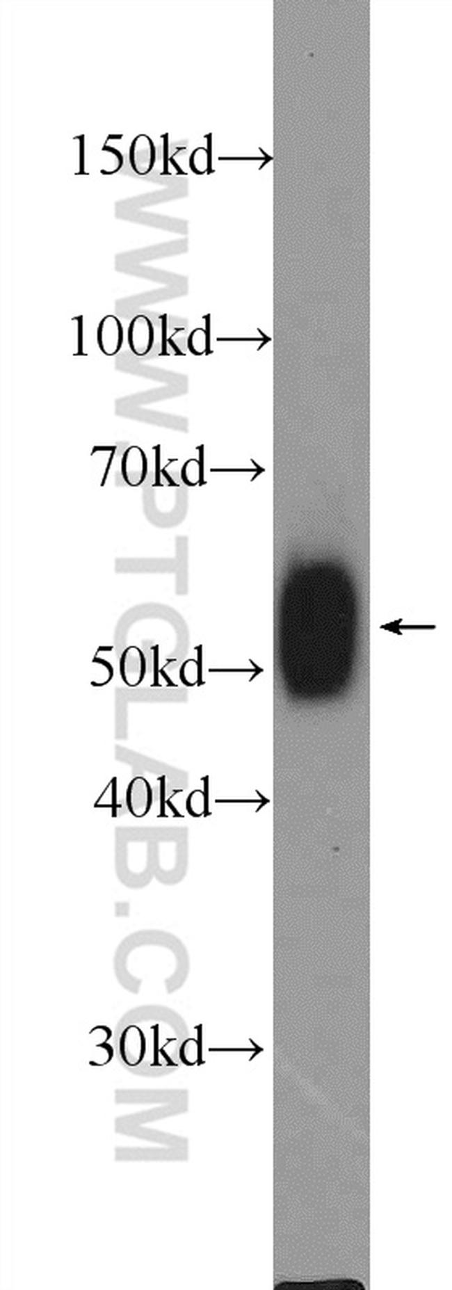 LCK Antibody in Western Blot (WB)