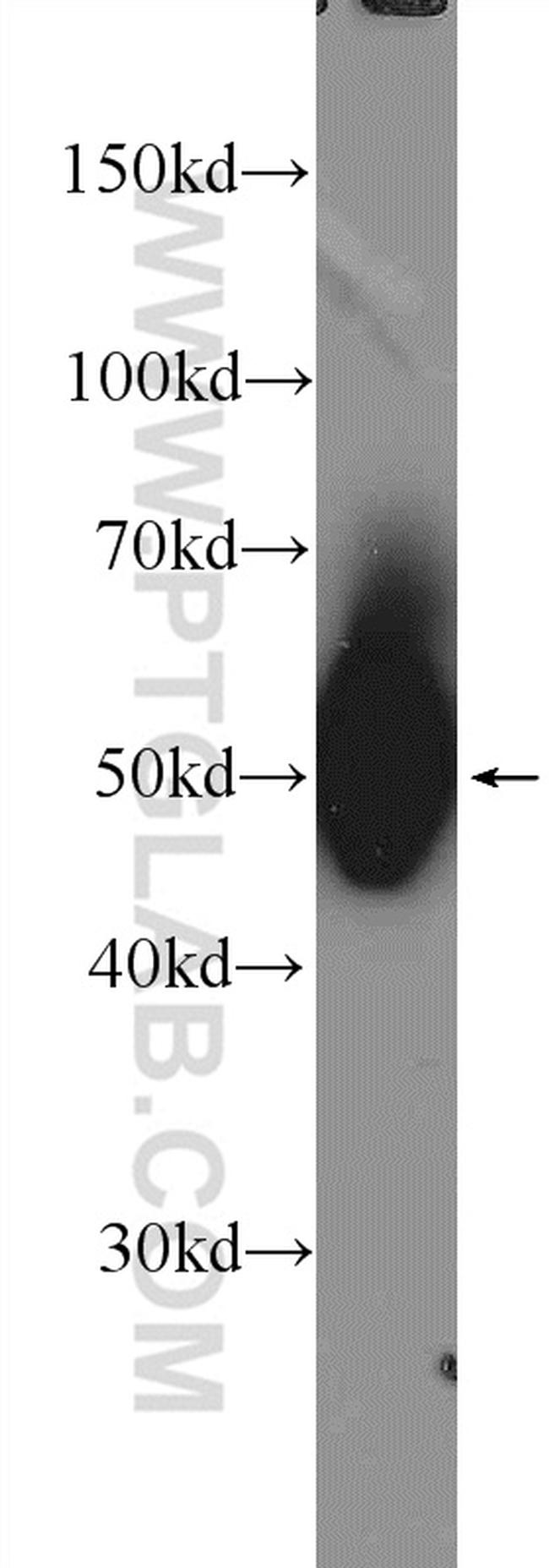 LCK Antibody in Western Blot (WB)