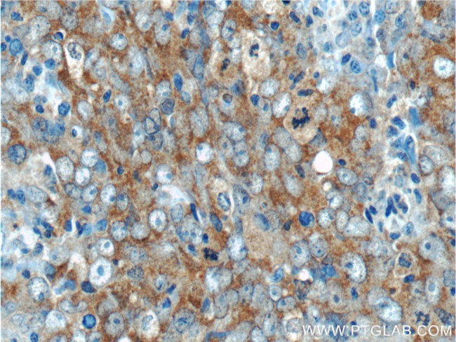 ARID4B Antibody in Immunohistochemistry (Paraffin) (IHC (P))