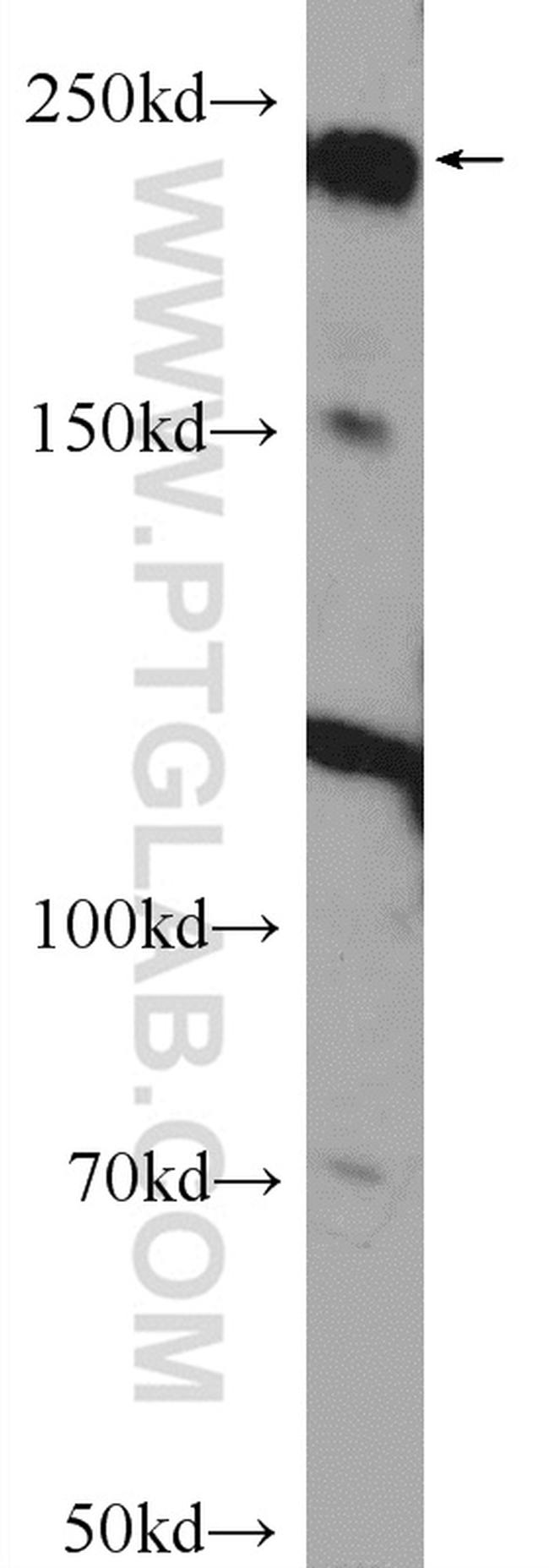 ARID4B Antibody in Western Blot (WB)