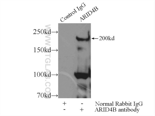 ARID4B Antibody in Immunoprecipitation (IP)