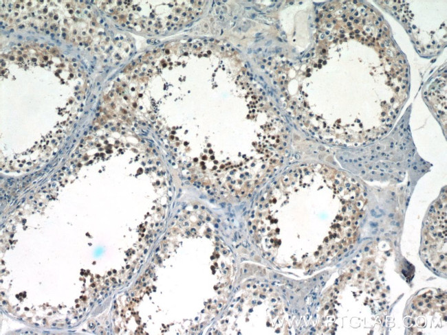 SALL4 Antibody in Immunohistochemistry (Paraffin) (IHC (P))