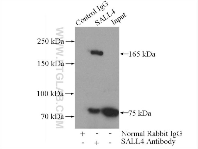 SALL4 Antibody in Immunoprecipitation (IP)