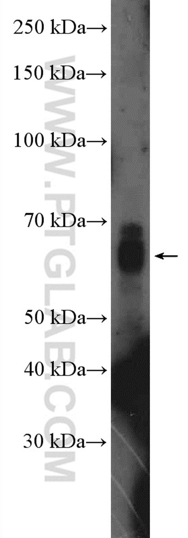 SALL4 Antibody in Western Blot (WB)