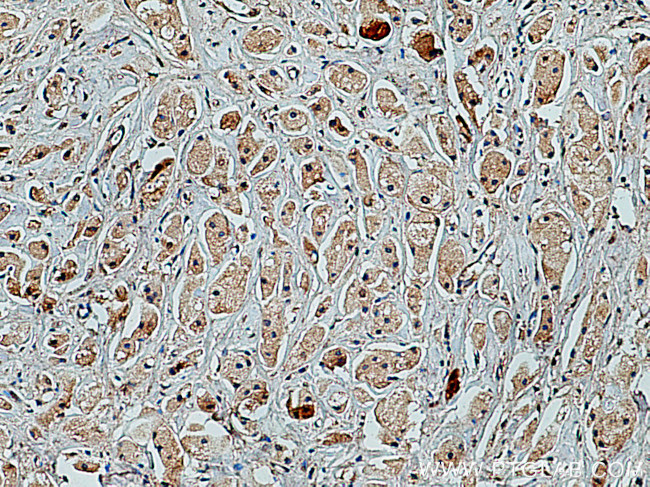 PRKACA Antibody in Immunohistochemistry (Paraffin) (IHC (P))