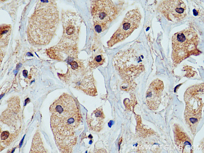 PRKACA Antibody in Immunohistochemistry (Paraffin) (IHC (P))