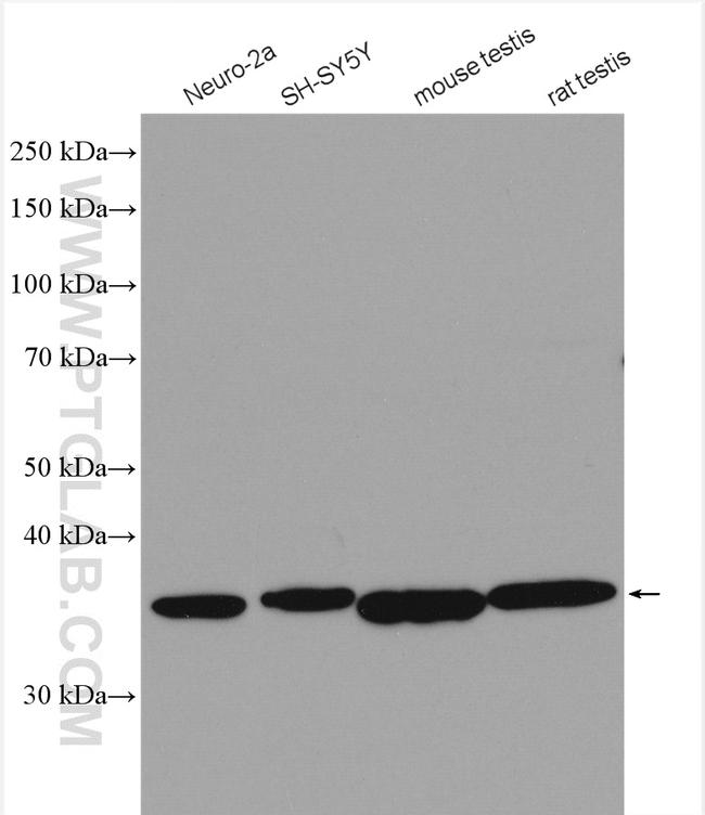 PRKACA Antibody in Western Blot (WB)