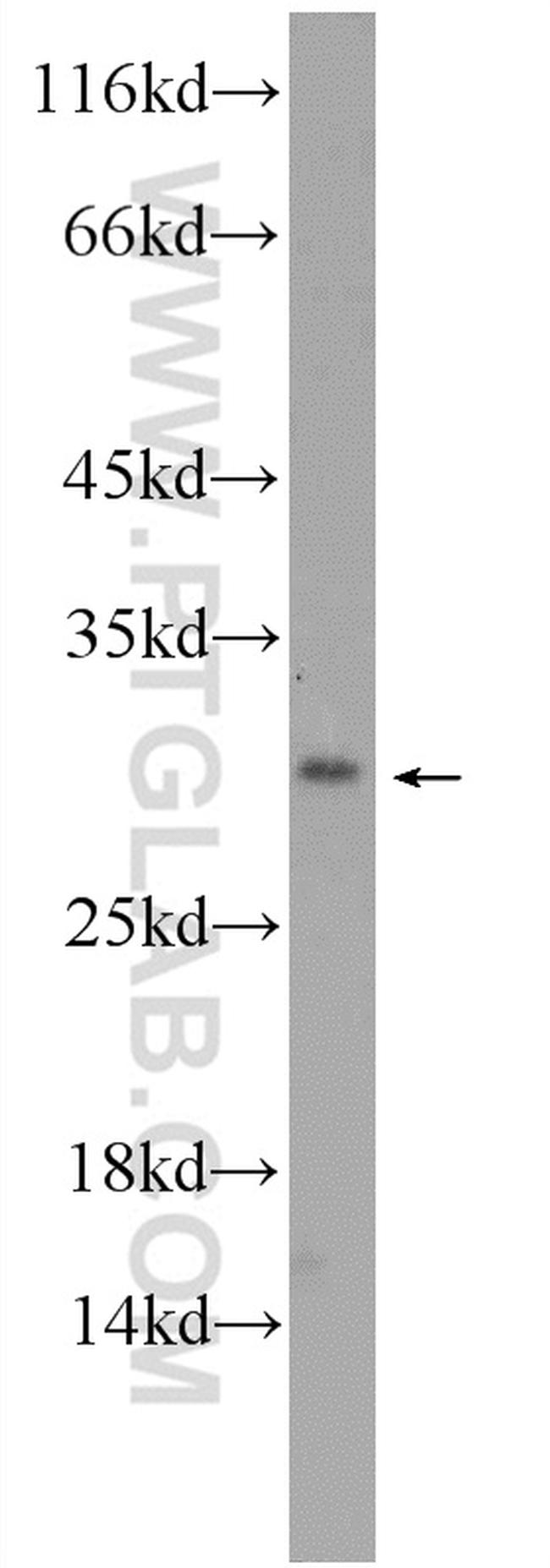 MAGIX Antibody in Western Blot (WB)