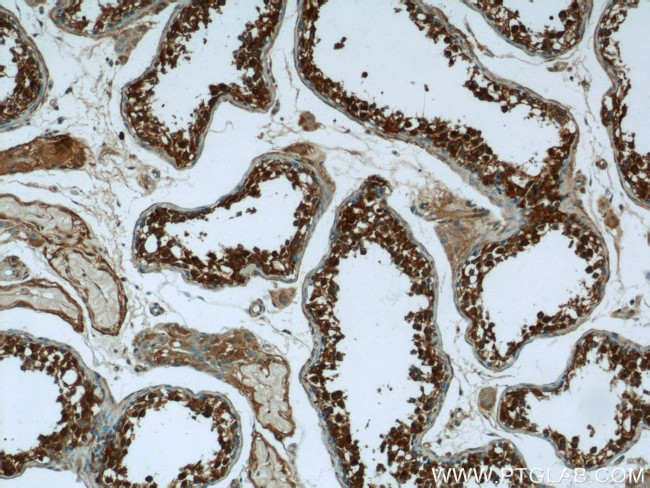 DHX57 Antibody in Immunohistochemistry (Paraffin) (IHC (P))