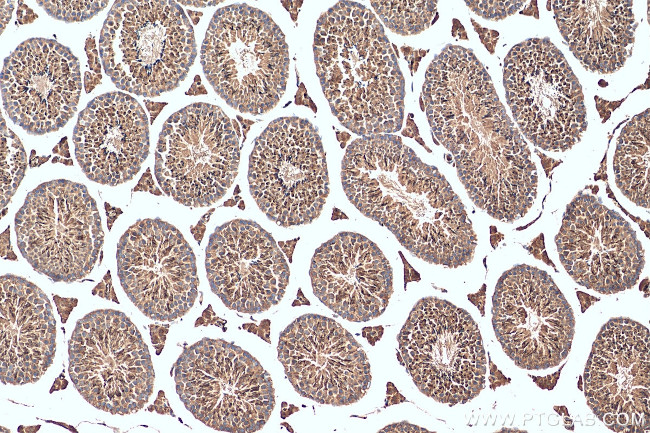 DHX57 Antibody in Immunohistochemistry (Paraffin) (IHC (P))