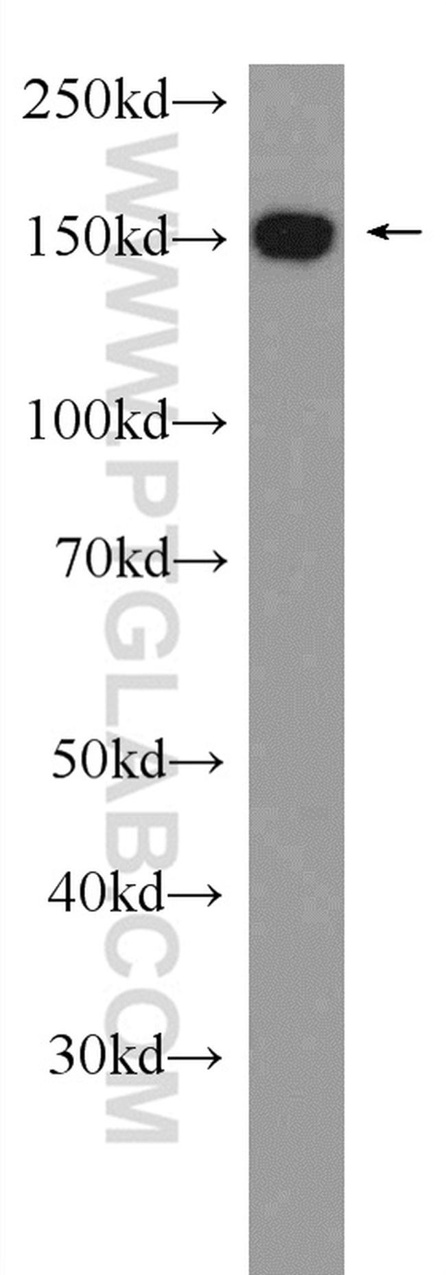 DHX57 Antibody in Western Blot (WB)