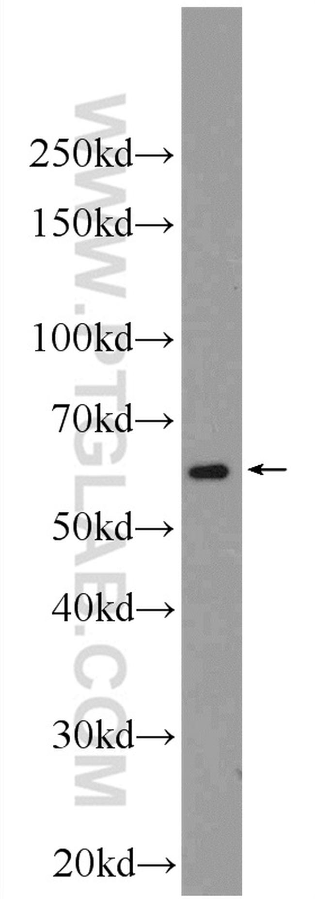 HPSE Antibody in Western Blot (WB)