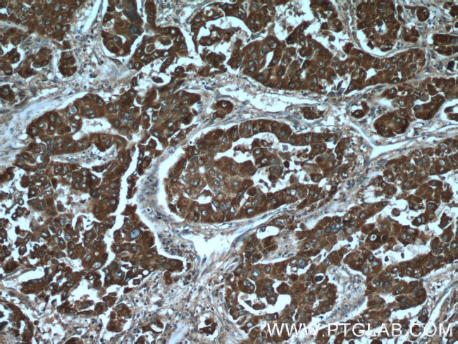 C10orf125 Antibody in Immunohistochemistry (Paraffin) (IHC (P))