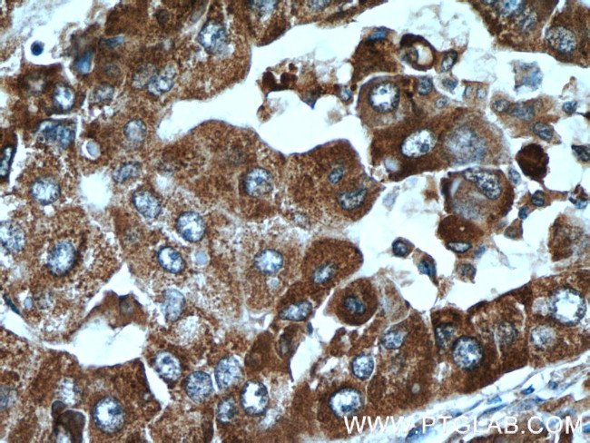 C10orf125 Antibody in Immunohistochemistry (Paraffin) (IHC (P))