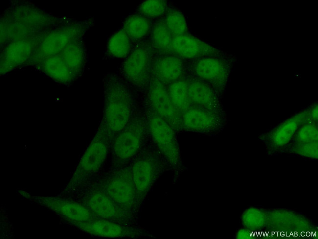 RPRD1B Antibody in Immunocytochemistry (ICC/IF)