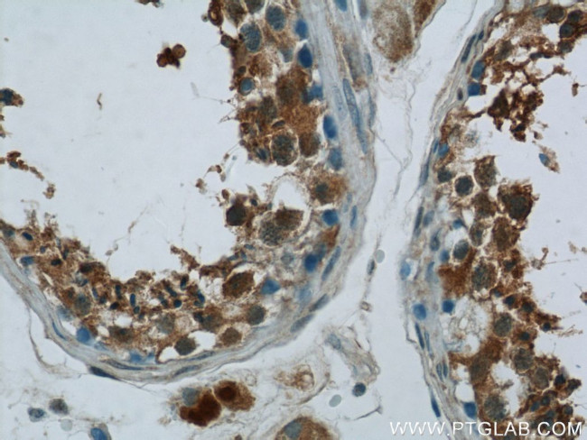 ZNF746 Antibody in Immunohistochemistry (Paraffin) (IHC (P))