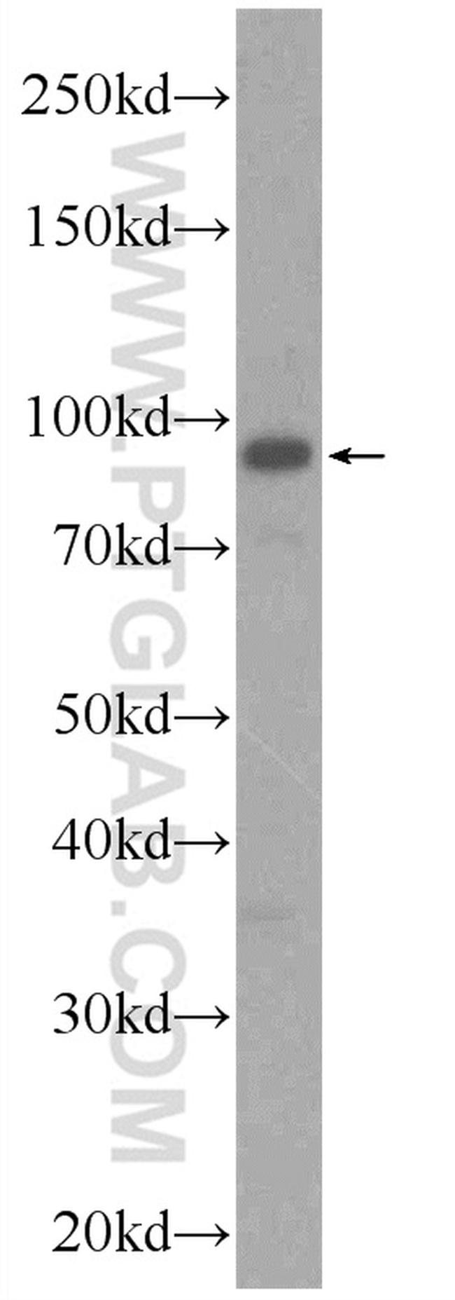 ZNF746 Antibody in Western Blot (WB)